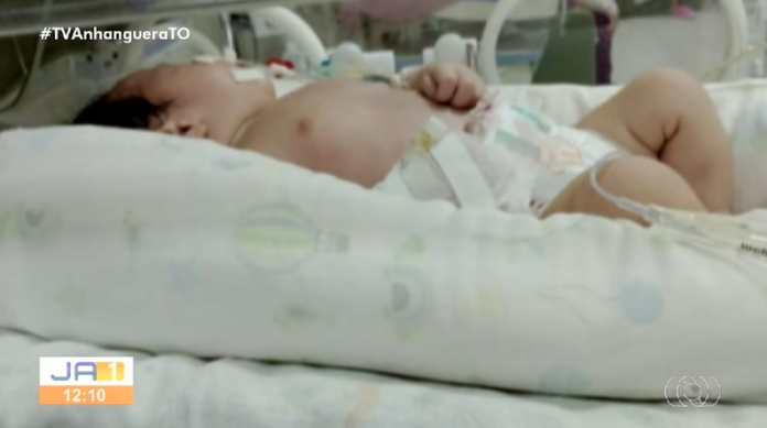 bebe-precisa-de-cirurgia-urgente-e-mae-diz-que-esta-esperando-ha-mais-de-20-dias: