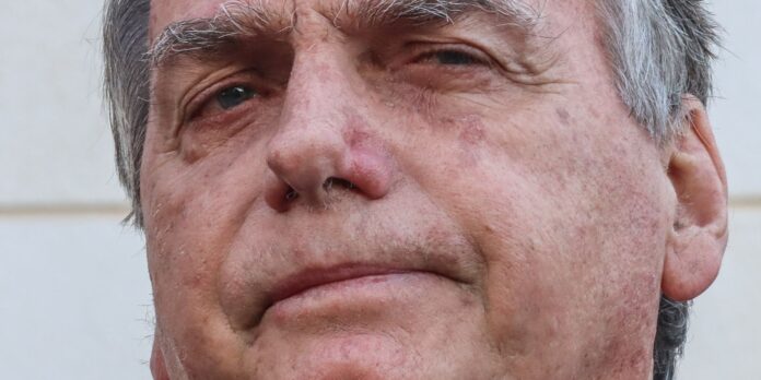 bolsonaro-apresenta-piora-clinica-e-vai-passar-por-novos-exames