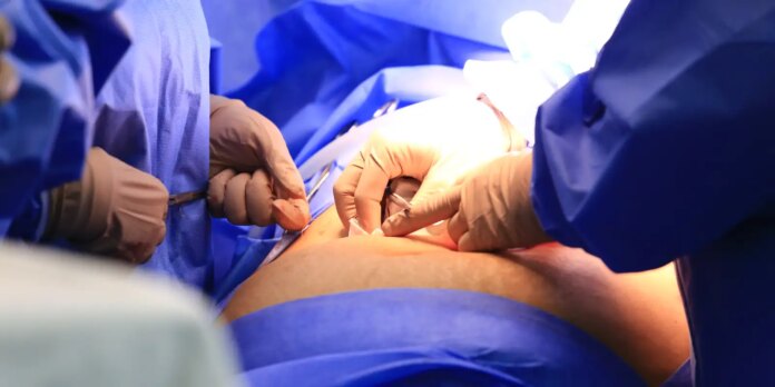 ceara-realiza-cirurgia-toracica-robotica-em-paciente-do-sus