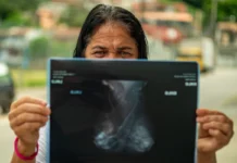 Moradores relatam doenças em área contaminada por petróleo no litoral de SP moradores-relatam-doencas-em-area-contaminada-por-petroleo-no-litoral-de-sp