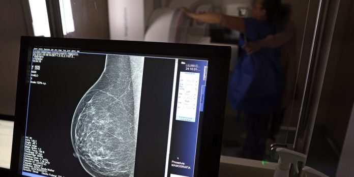 cancer-de-mama:-diagnostico-precoce-amplia-chance-de-cura cancer-de-mama:-diagnostico-precoce-amplia-chance-de-cura