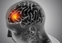 AVC: neurologista explica como identificar os primeiros sinais avc:-neurologista-explica-como-identificar-os-primeiros-sinais